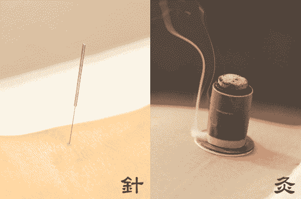 針灸