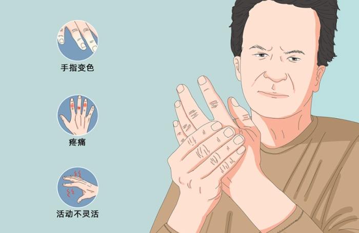 突然手麻原因