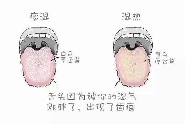 舌苔白吃什麼