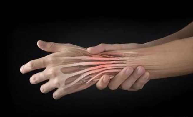 肌腱炎恢復時間