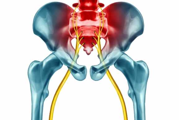 坐骨神經痛症狀