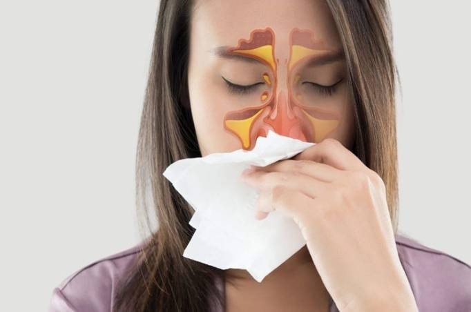 中醫鼻竇炎治療