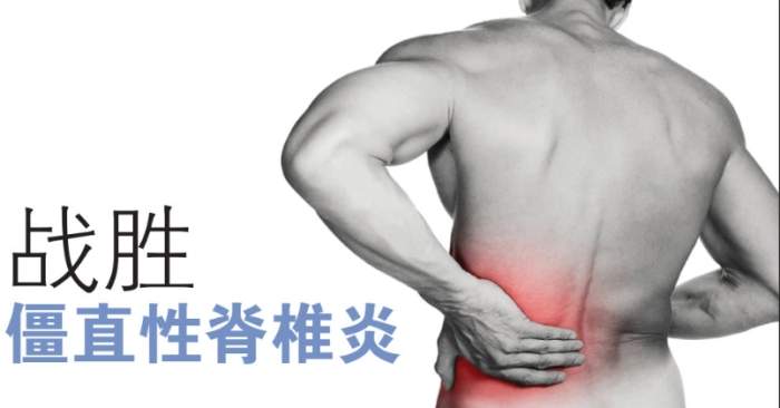 僵直性脊椎炎治療 僵直性脊椎炎治療