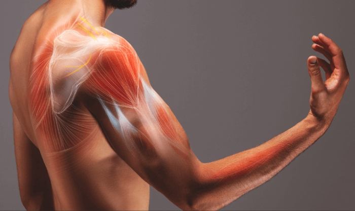 肌肉拉傷恢復時間