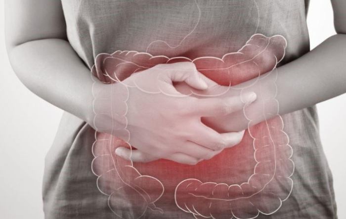 大腸激躁症 放屁