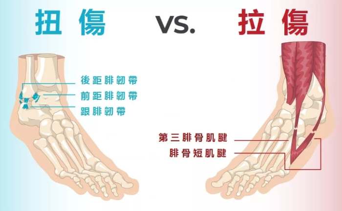 腳翻船恢復時間