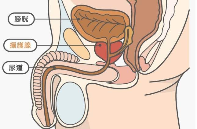 中醫攝護腺治療