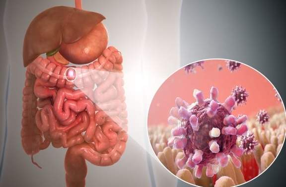 中藥治療腸胃炎