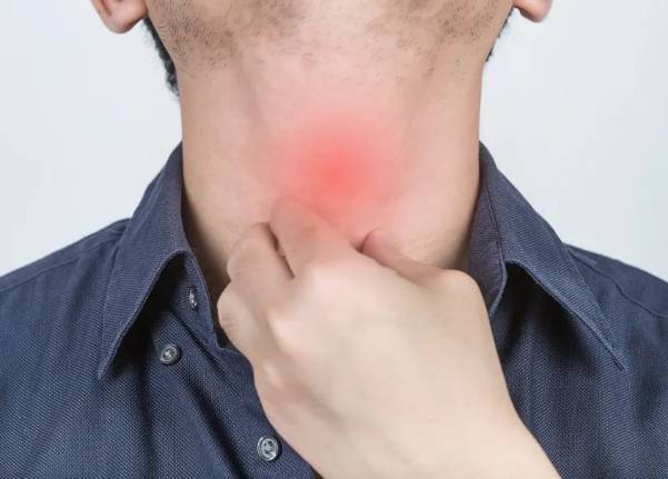 中藥治療咽喉炎