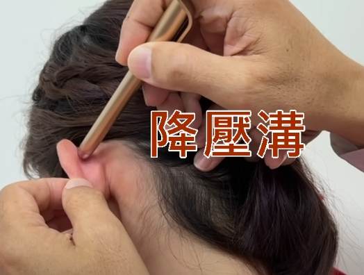 耳穴降血壓 耳穴降血壓