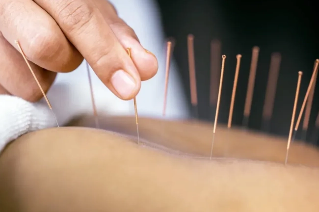 針灸疼痛副作用