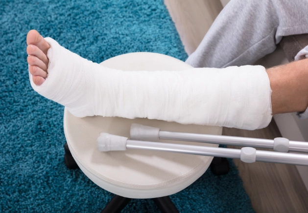 打石膏注意事項