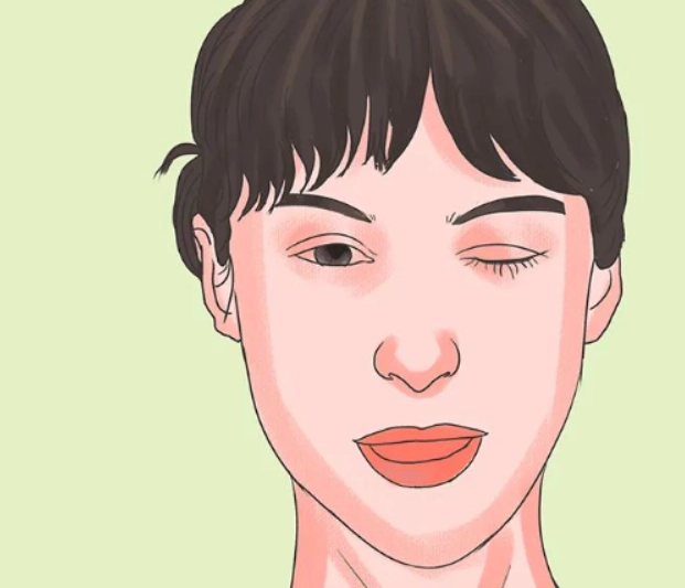 重症肌無力症病因 重症肌無力症病因