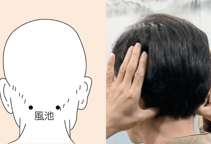 風池穴疼痛