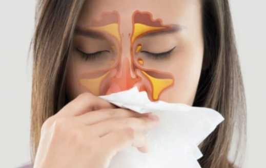 鼻竇炎中藥方全攻略：有效治療方法与個人經驗分享