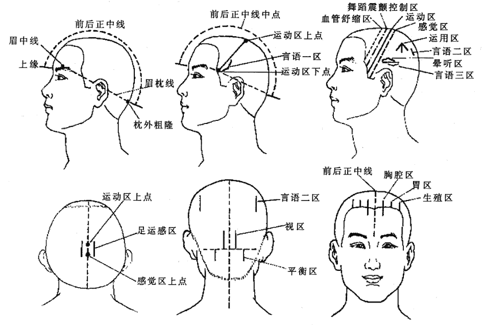 針灸原理