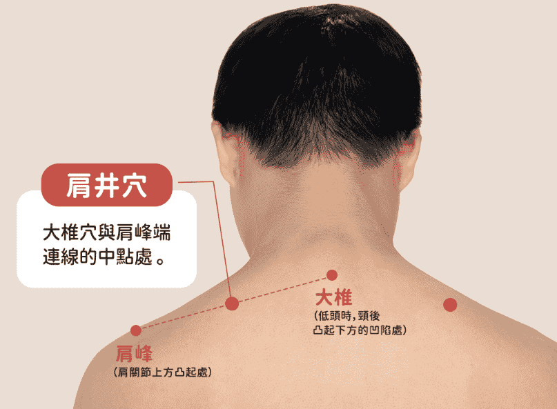 中醫診斷頸椎痛的方法