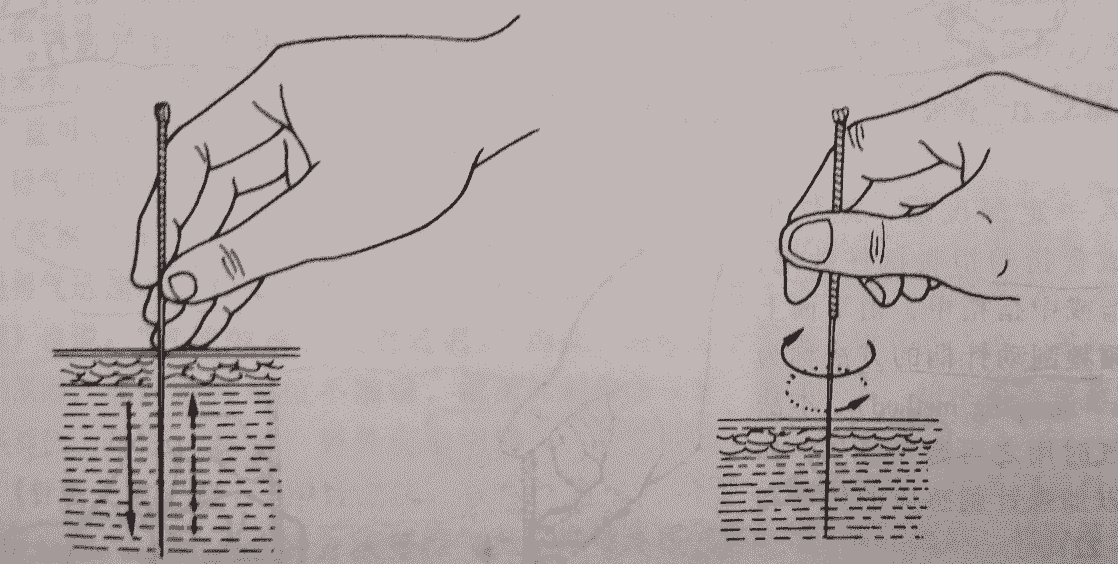 針灸方法