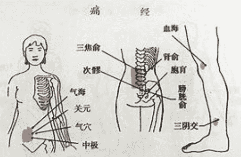 痛經診斷