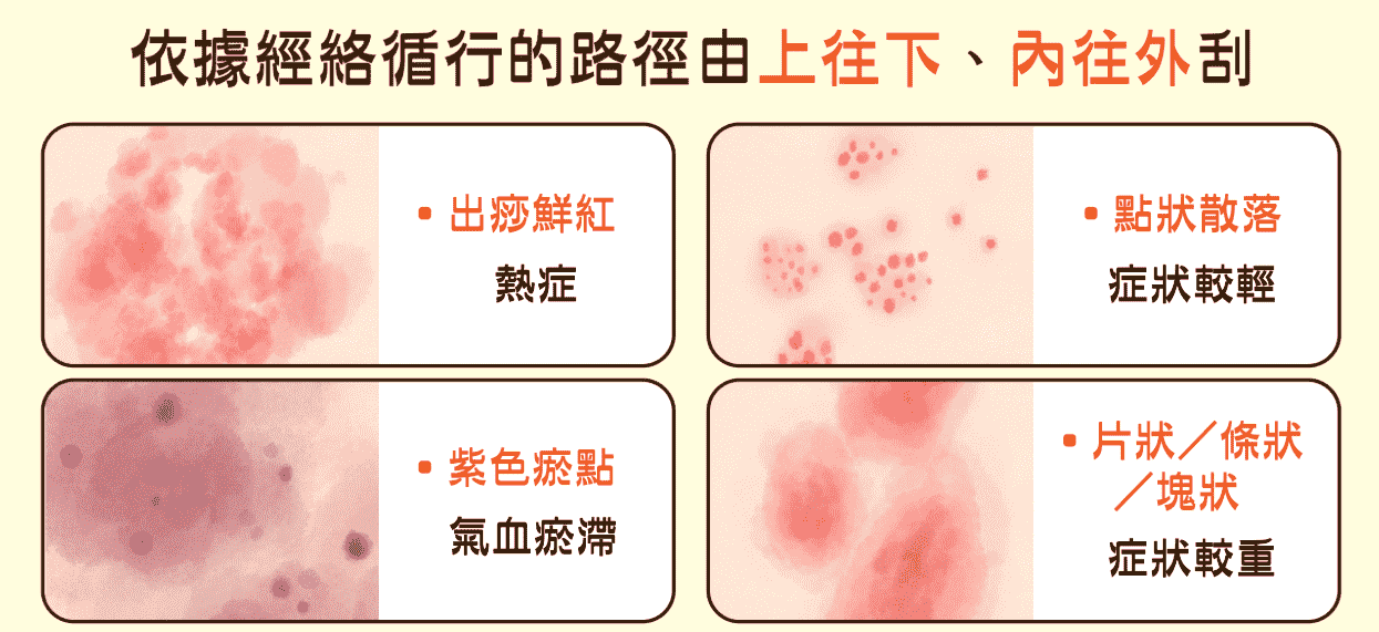 中醫刮痧方法 中醫刮痧方法