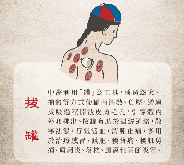 中醫拔罐原理