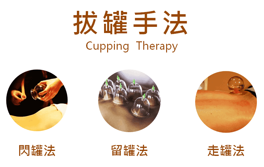 中醫拔罐方法