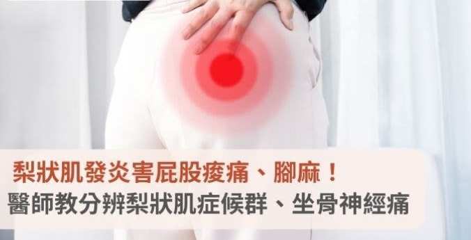 梨狀肌發炎症狀