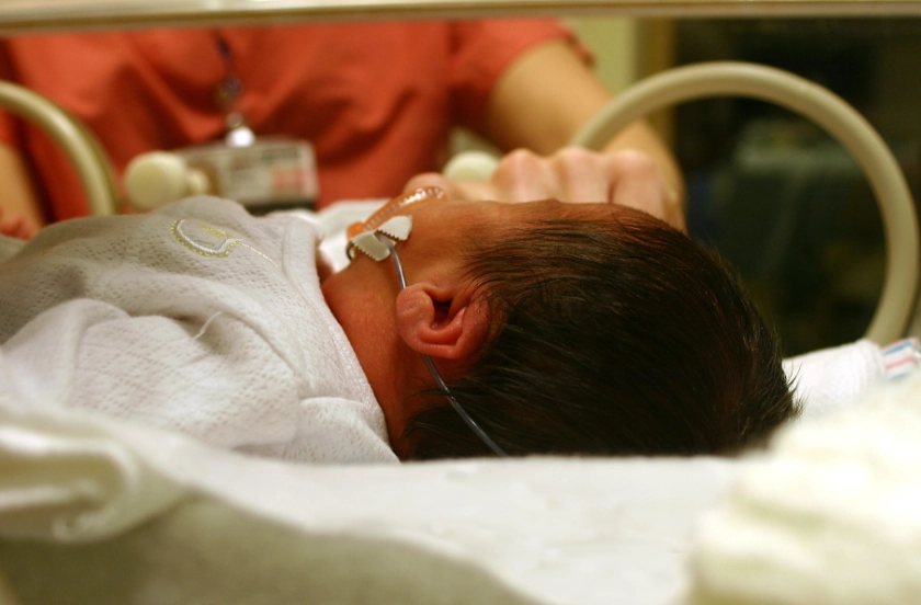 新生兒黃疸標準