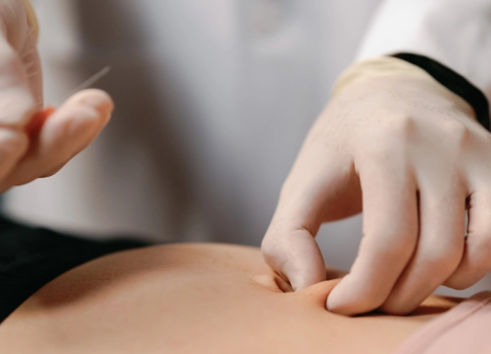 針灸功效