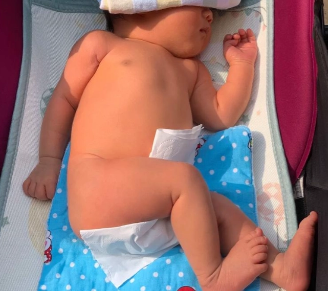 黃疸指數13正常嗎