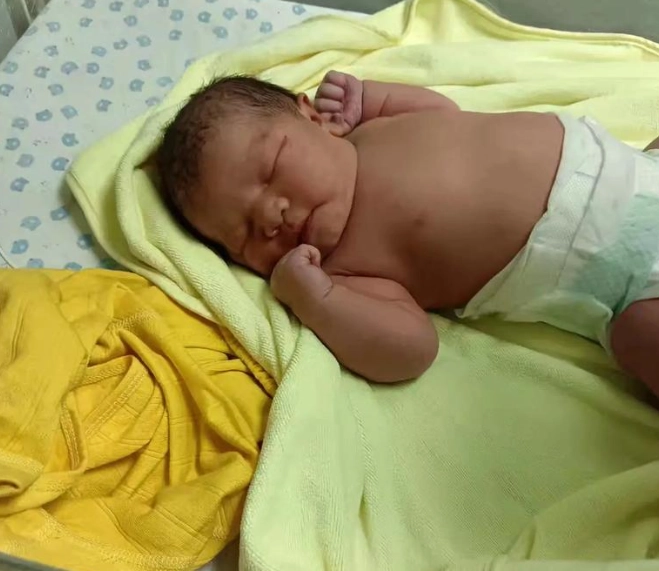 新生兒黃疸正常值