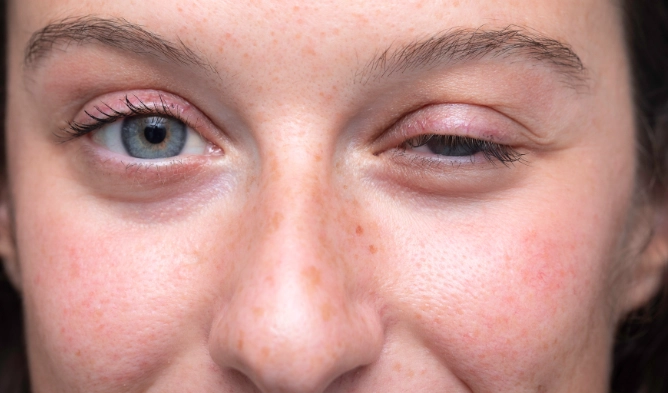 肌無力症看哪一科