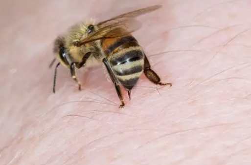 被蜜蜂叮找不到針