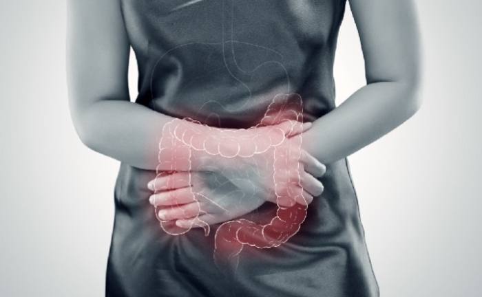 腸躁症中藥治療