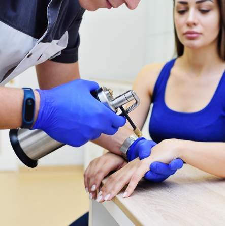 皮膚科冷凍治療健保