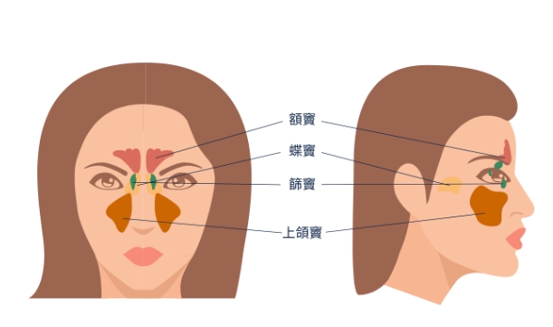 慢性鼻竇炎會自己好嗎