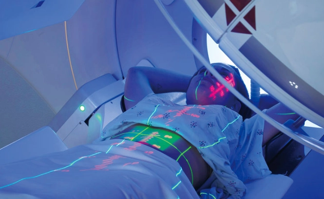 癌症電療多久做一次