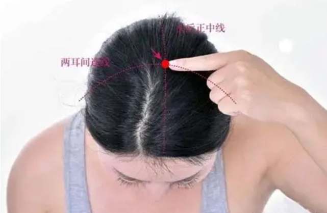 百會穴凹陷怎麼辦？完整解析原因與自我改善方法