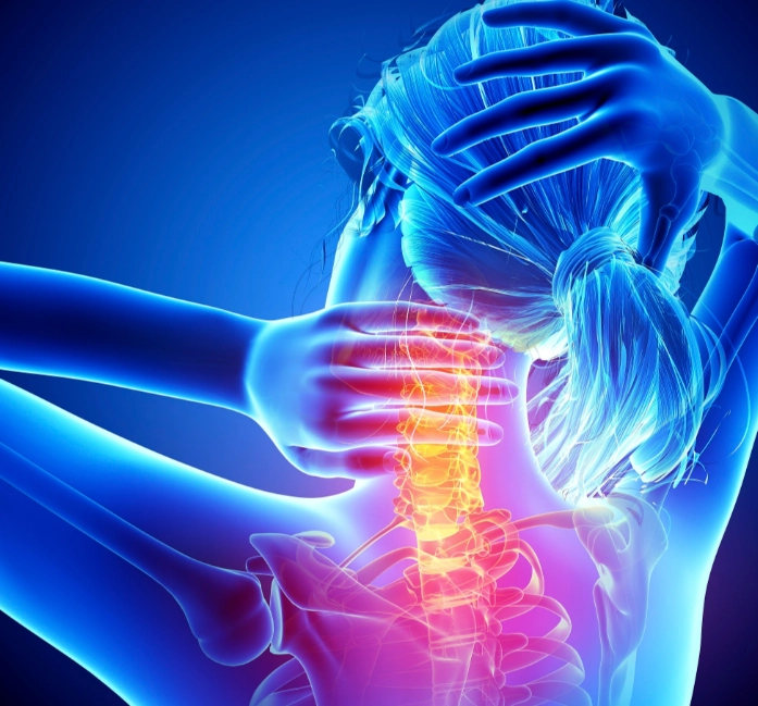 神经根型颈椎病