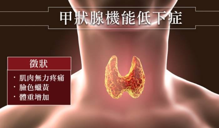 甲狀腺低下會好嗎