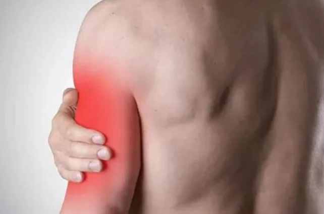 肩膀脫臼後遺症