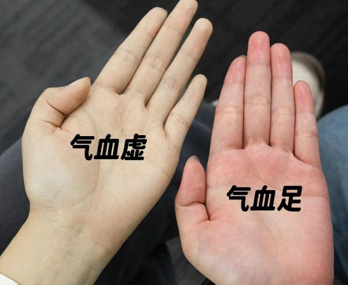 氣血虛不能吃什麼