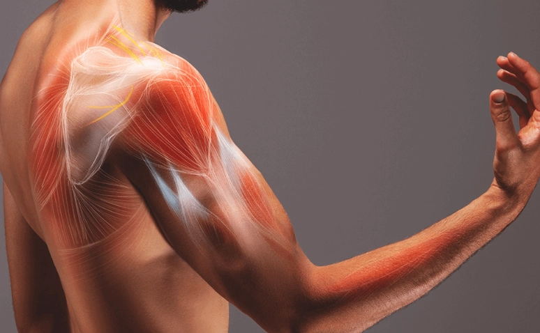 肌肉拉傷會自己好嗎