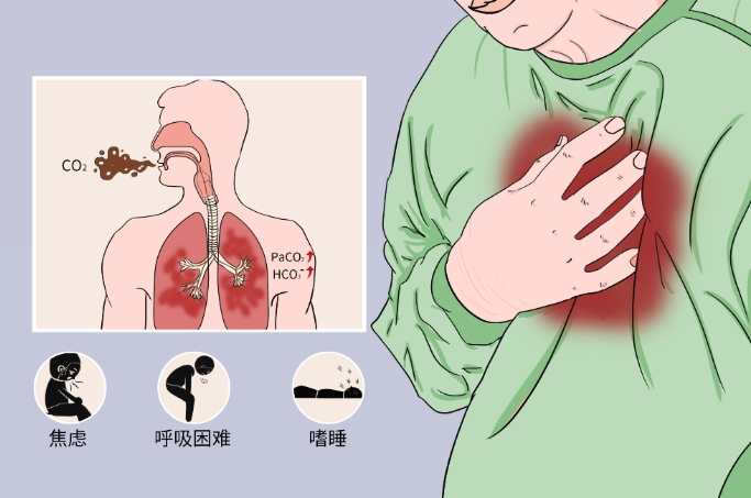 二氧化碳濃度過高症狀