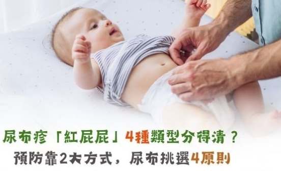 嬰兒紅屁股凡士林