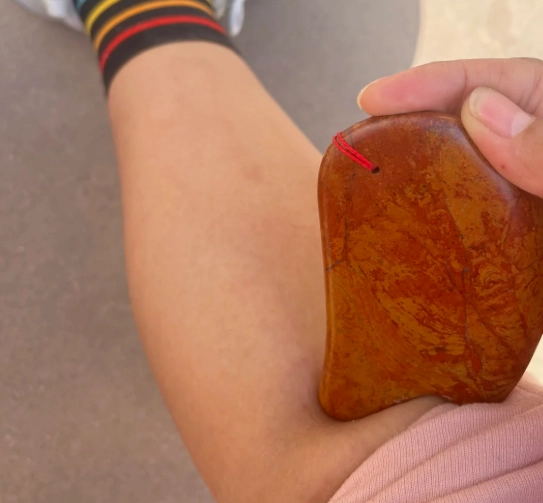 陰陵泉刮痧全攻略：改善水腫痠痛的穴位療法技巧與注意事項