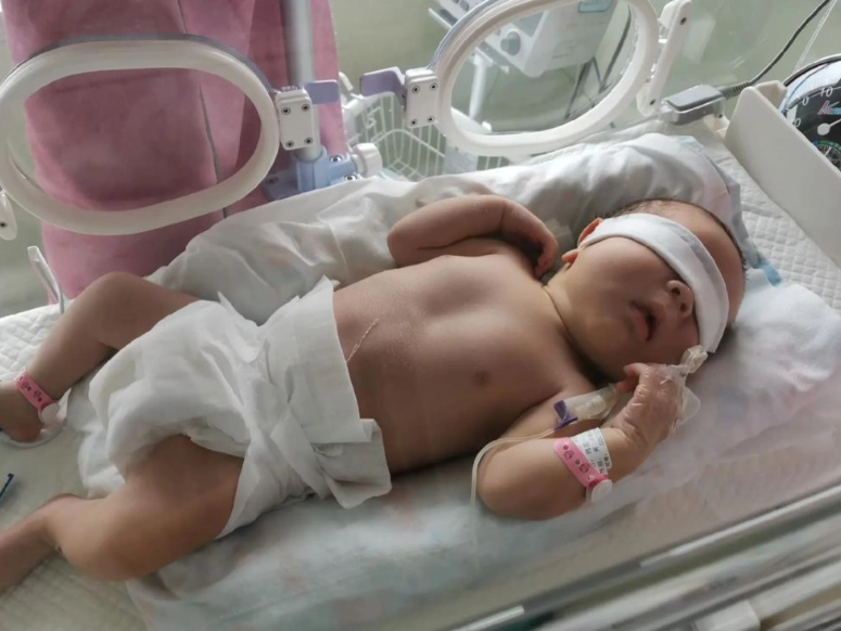 新生兒黃疸多久會退