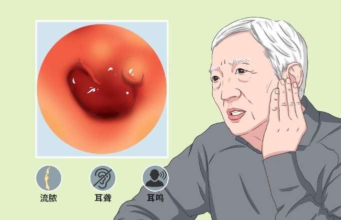 中耳炎耳鳴多久會好