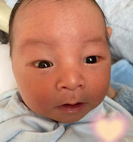 黃膽素高嬰兒