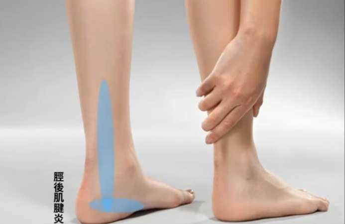 腳踝韌帶受傷多久會好